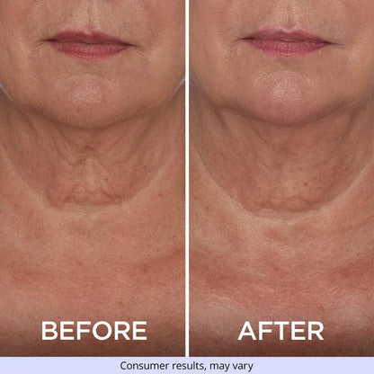 Tighten & Lift Neck Cream