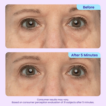 Instant Lift Eye Gel