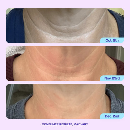 Tighten & Lift Facial Trio