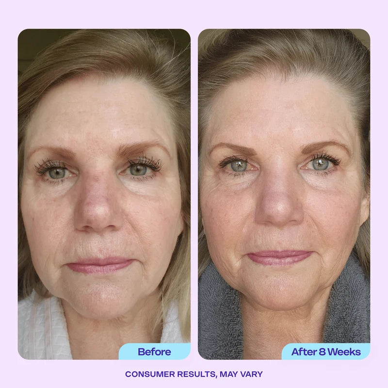 Tighten & Lift Facial Trio